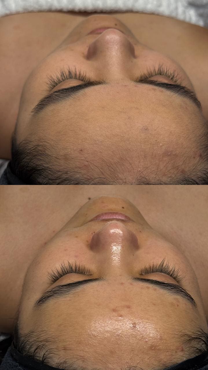 Facial Correctivo