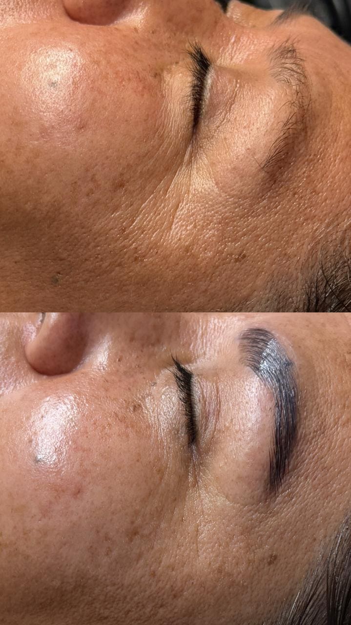 Lifting Facial