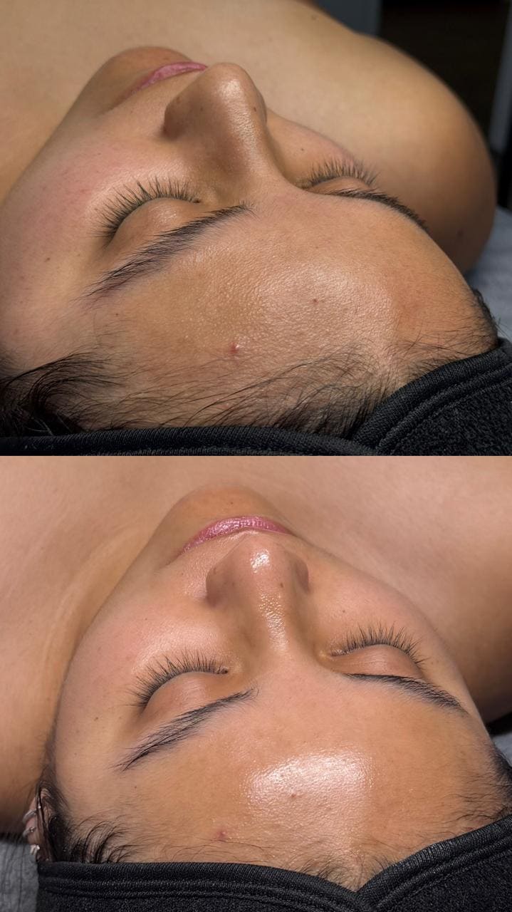 Facial Detox